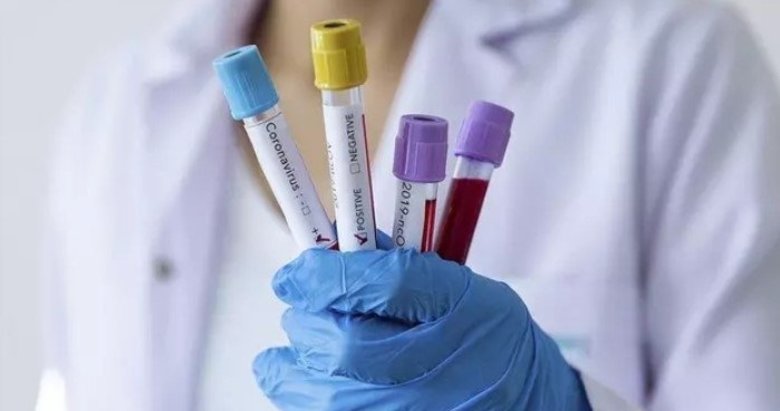 Bilim Kurulu üyesinden canlı yayında dikkat çeken açıklama!