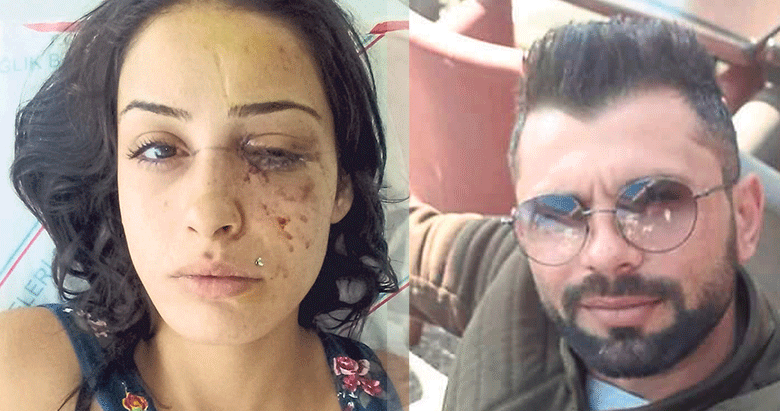 Beste: Bu adamın tutuklanması için ölmem mi lazım!