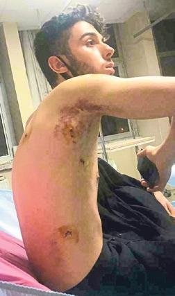 Hapisten çıktı, aynı kişiyi yine bıçakladı