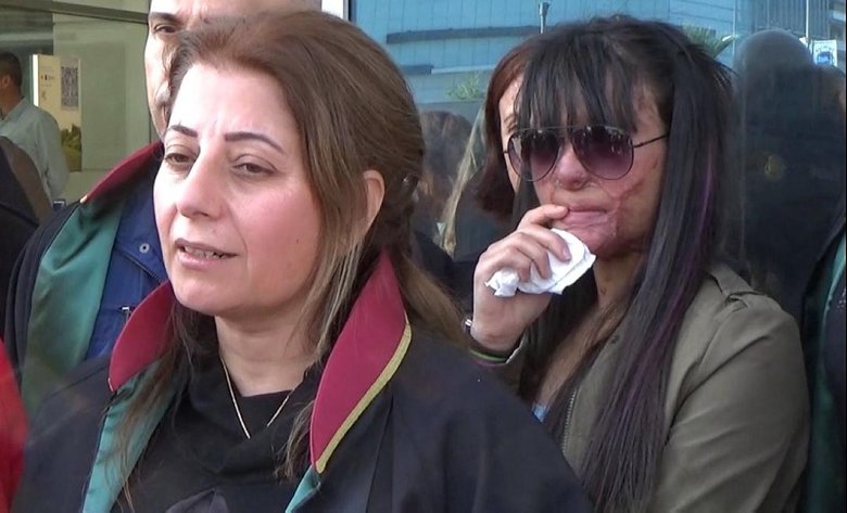 Yüzüne asit atılan Berfin: Kadına şiddet son bulsun