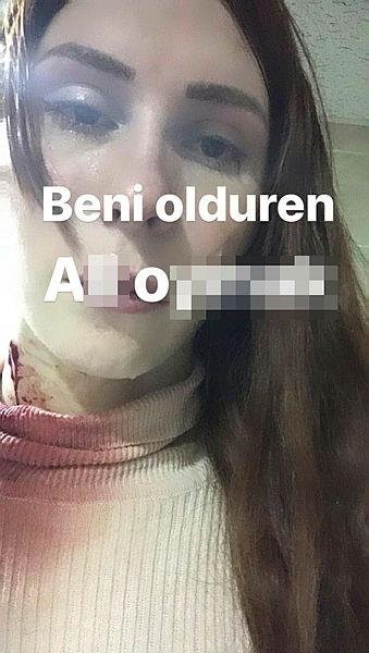 Ölmeden önce kanlı fotoğrafının üzerine isim yazarak paylaşmış