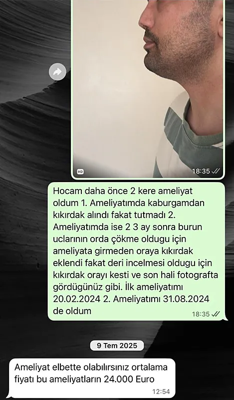 horlama-sikayetiyle-gitti-hayati-karardi-4-ameliyat-oldu-duzelmesi-icin-daha-kac-kere-olmam-gerek-1782810747613.jpg