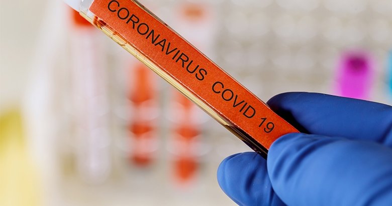 Bugünkü Koronavirüs vaka tablosu belli oldu
