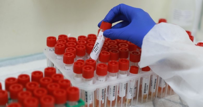 Oxford Üniversitesi’den dikkat çeken çalışma: Koronavirüse yakalananlar...