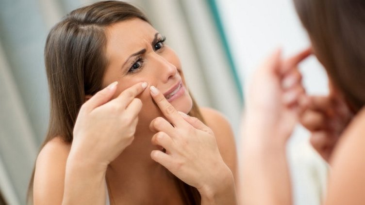 Sivilce nasıl geçer? Sivilce izi nasıl yok olur?