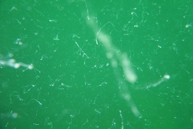 Müsilaj kabusu geri dönüyor mu? Uzmanı değerlendirdi