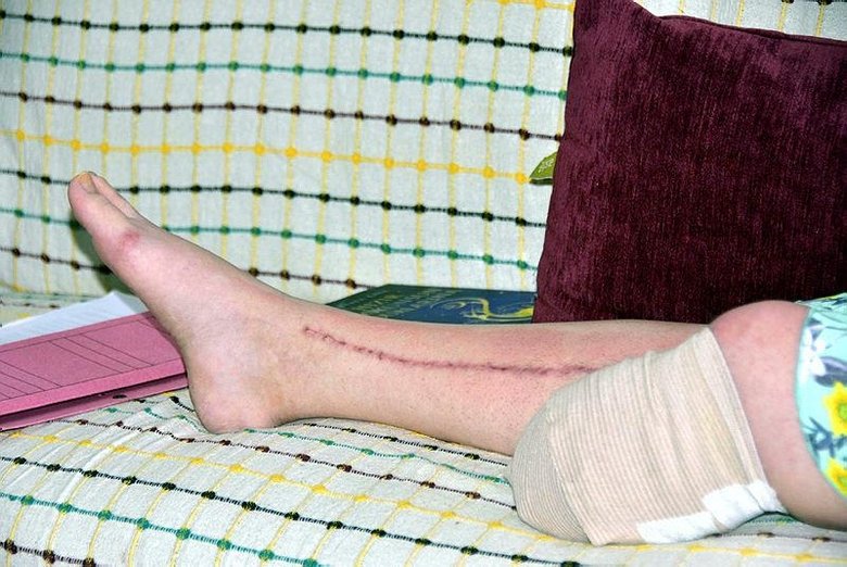 İzmir’de eşini vurup bacağının kesilmesine neden olan cani: Böyle bir evlilik hayal etmedim