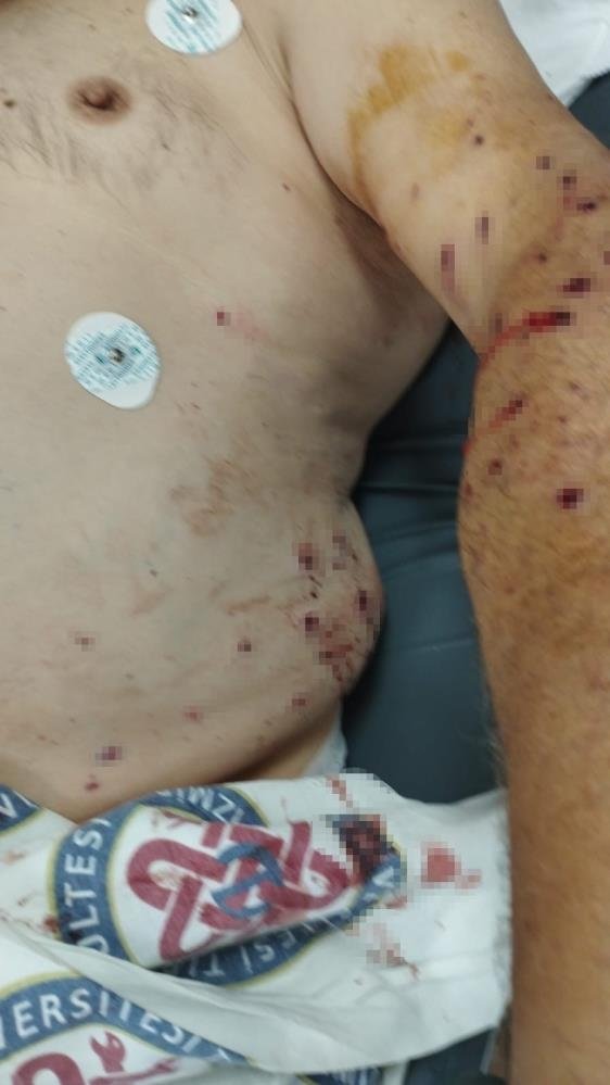 İzmir’de TIR sahibi 180 liralık kantar ücreti için çalışanı vurdu