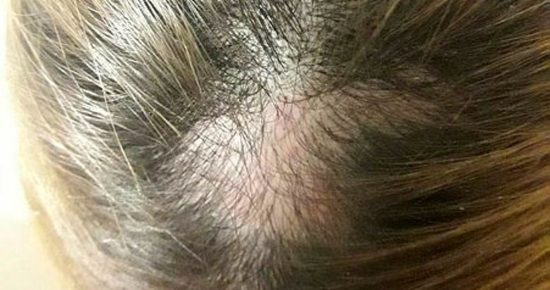İzmir’de hasta yakını 112 görevlisi kadının saçlarını kopardı