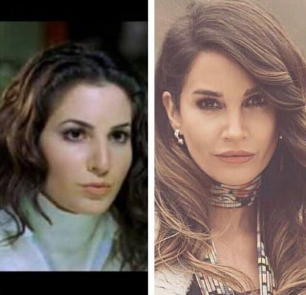 Bir Zamanlar Cukurova Nin Zuleyha Si Hilal Altinbilek Estetiksiz Haliyle Sok Etti Galeri Yeni Asir