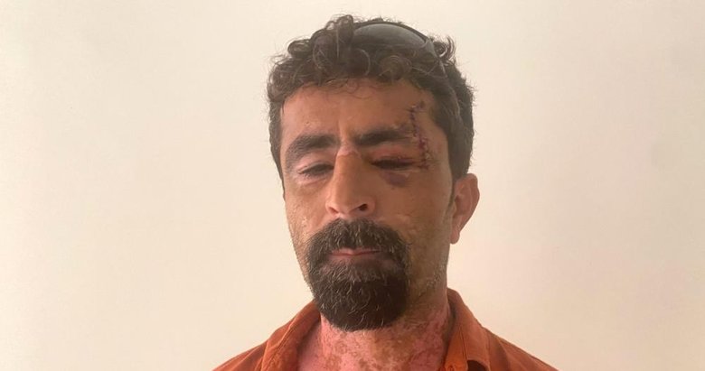 Öfkeli damat kayınpederini hastanelik etti: Kırık cam ile boğazımı kesmeye çalıştı