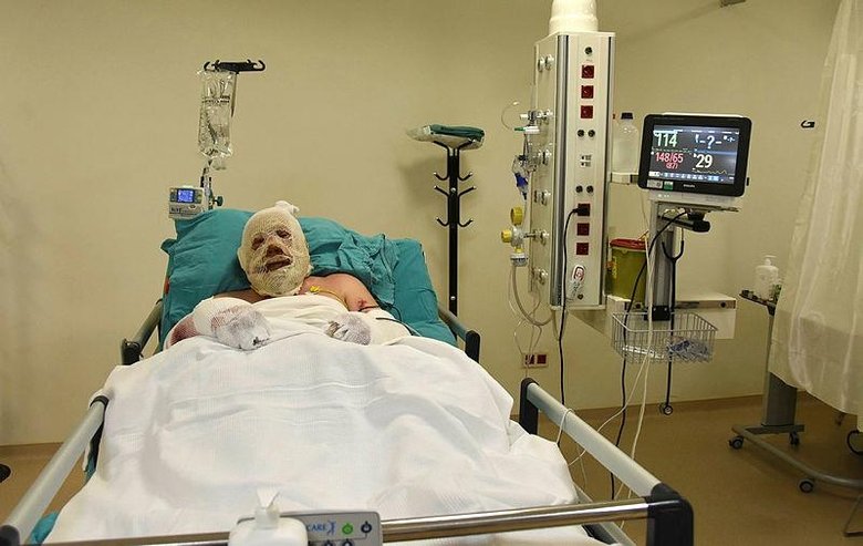 Yangınla savaşırken alevler arasında kaldı! Yaşadığı dehşet anlarını böyle anlattı