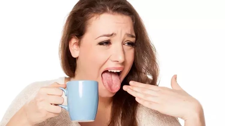 Diliniz yanığı nasıl geçer ve iyileşir?