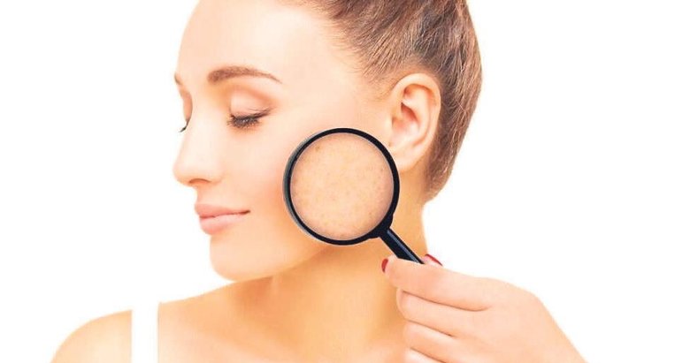 Şifalı bitkilerle lekesiz ciltler