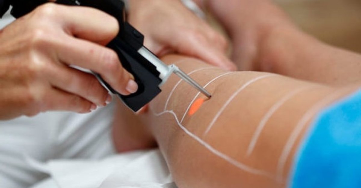 Konya'da lazer epilasyon skandalı!