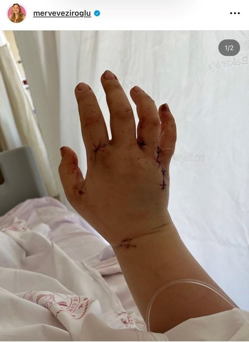 Eşi tarafından 32 kez bıçaklanmıştı! Youtuber Merve Veziroğlu’ndan paylaşım geldi