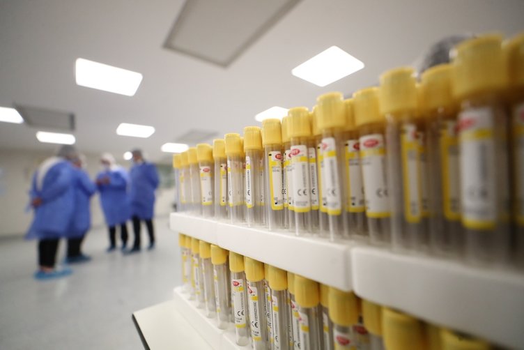 AIDS belirtileri neler? AIDS nasıl bulaşır? AIDS tedavisi var mı?