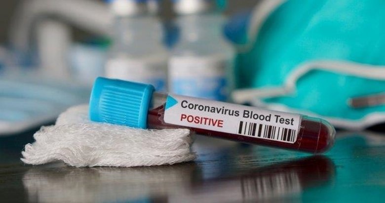 Pozitif vakanın ardından koronavirüs testi yapma kriterleri genişletildi