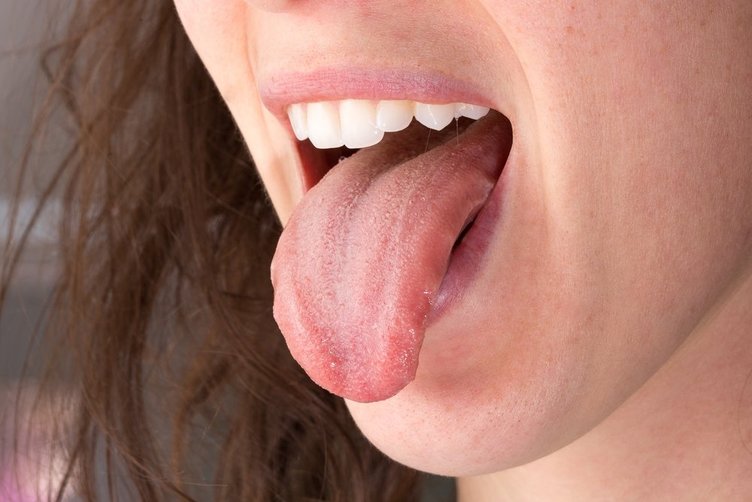 Dilinizin rengini bilin sağlığınızın ön kontrolünü yapın!