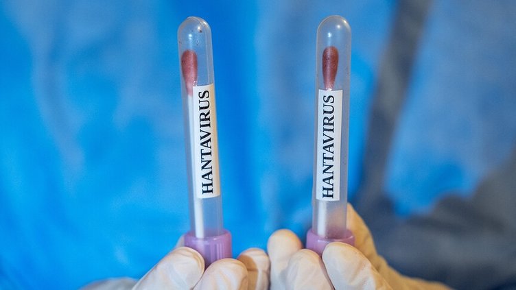 Hantavirüs belirtileri neler? Hantavirüs nedir, nasıl anlaşılır?