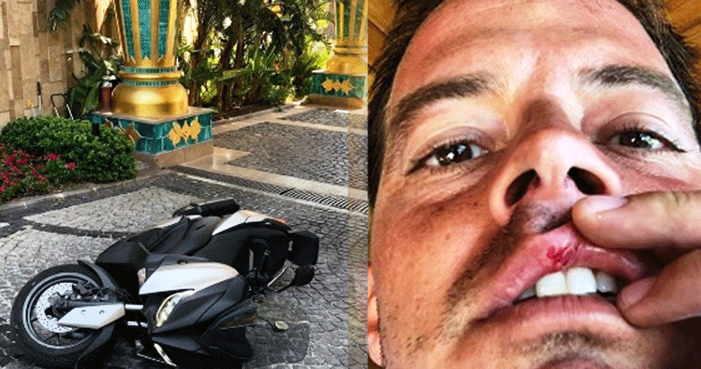 Alp Kırşan tatilde motosikletiyle kaza yaptı