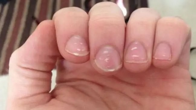 Her gün kola içtiğimizde oluşan etkileri: Fazla kola içmek zararlı mı?