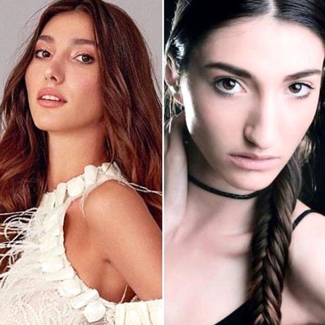 2018 Miss Turkey birincisi Şevval Şahin’in estetiksiz hali ortaya çıktı