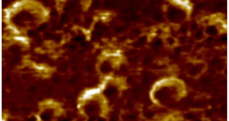 Türk bilim insanları yerli süper mikroskopla Kovid-19’u görüntülemeyi başardı