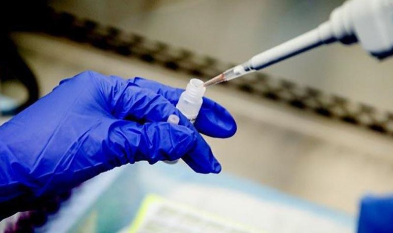 Izmir De Koronavirus Testi Yapan Hastaneler Hanginleri Nerede Korona Testi Yaptirilir