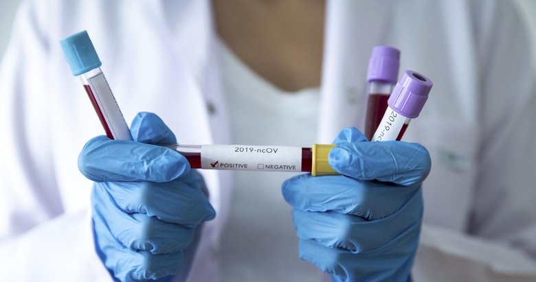 Son dakika: Koronavirüs vaka tablosu açıklandı! 11 Mart vaka tablosu...