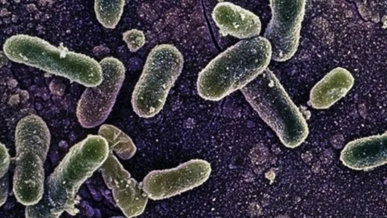 salmonella-belirtileri-neler-salmonella-zehirlenmesi-nasil-anlasilir-kac-gunde-belli-olur-1787653597788.jpeg