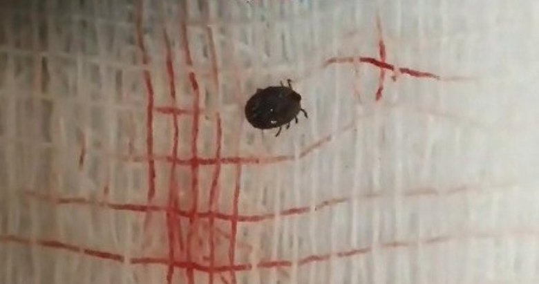 Ağrı şikayetiyle doktora gitti, gözünde canlı kene çıktı