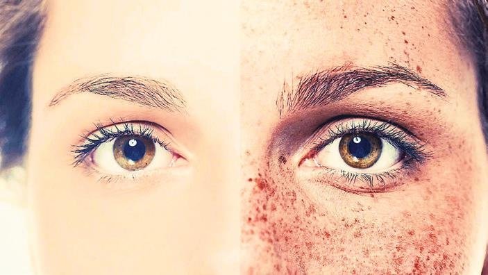 Kusurları sergileme cesareti: Cilt dekonstrüksiyonu