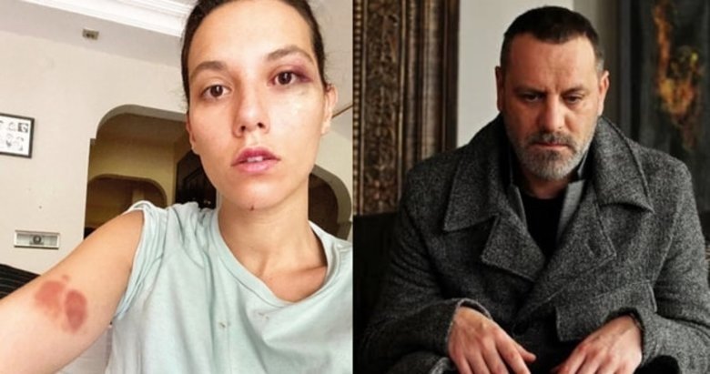 Deniz Bulutsuz’u darp eden Ozan Güven’in evinin etrafındaki kameralar incelenecek