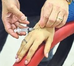 Hipnozla korkusuz ve ağrısız diş operasyonu