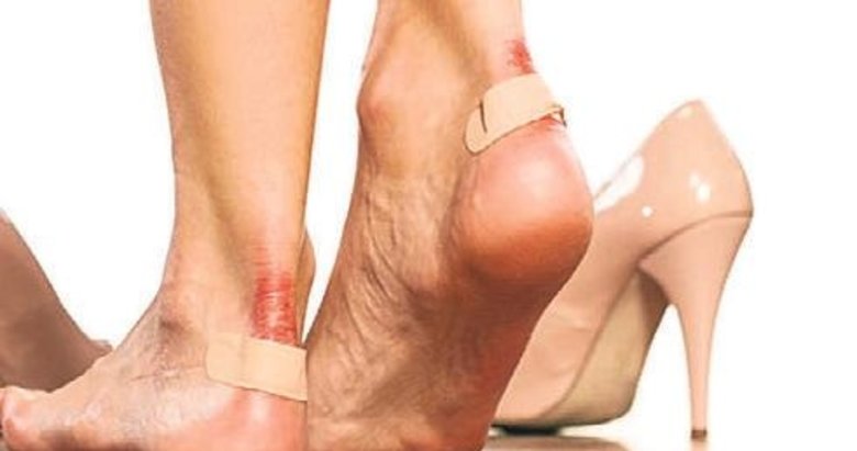 Kadınların ayakları 9 kat daha çok ağrıyor