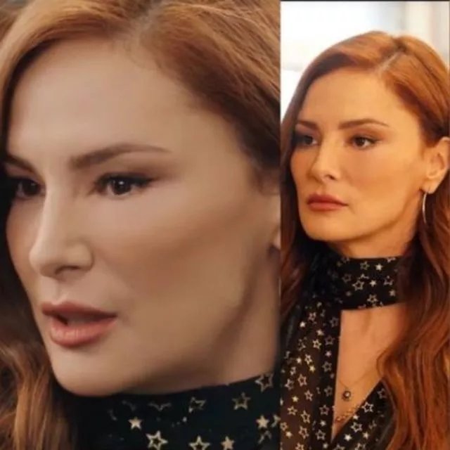 Mine Tugay’ın yüzüne ne oldu? Sosyal medya çalkalandı