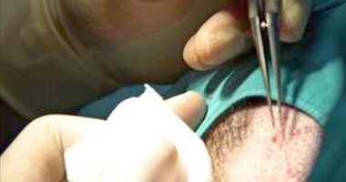 Trabzon’da korkunç olay! Sadece saç ekimi yaptırmak istemişti: Öldü