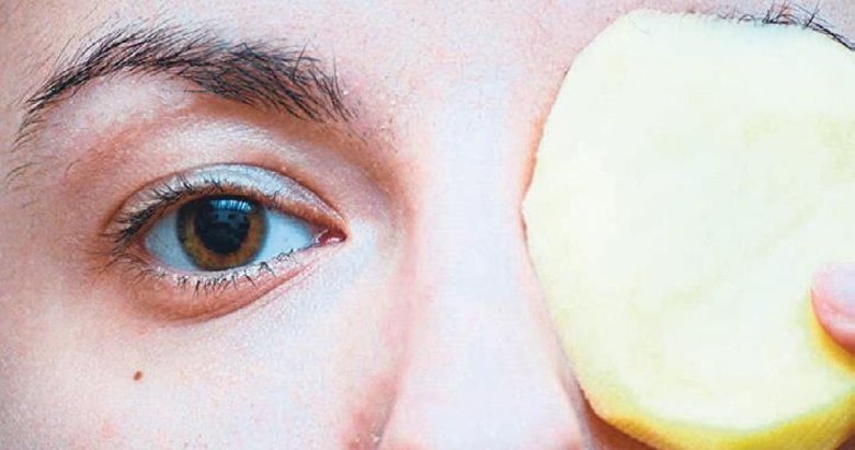 Patates masajı ile arpacıktan kurtulun