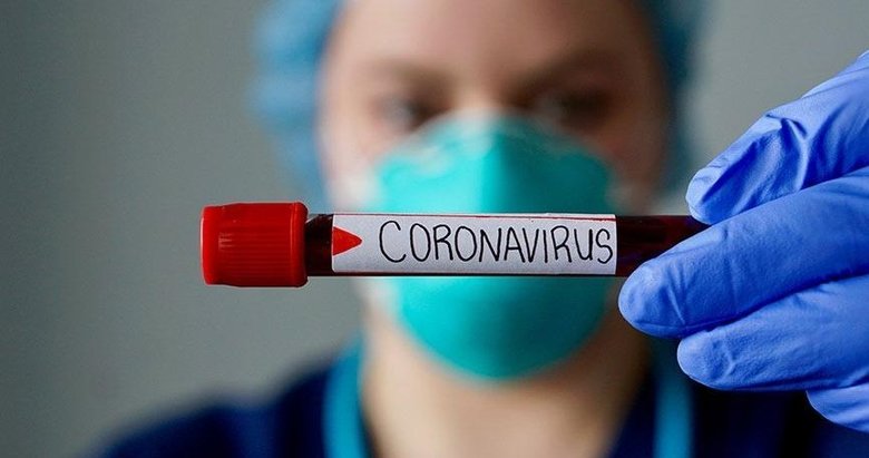 Özel hastanelerin koronavirüs kurnazlığı! Test için para istiyorlar