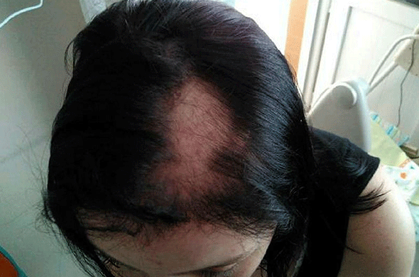 Öldüğüyle kaldı!