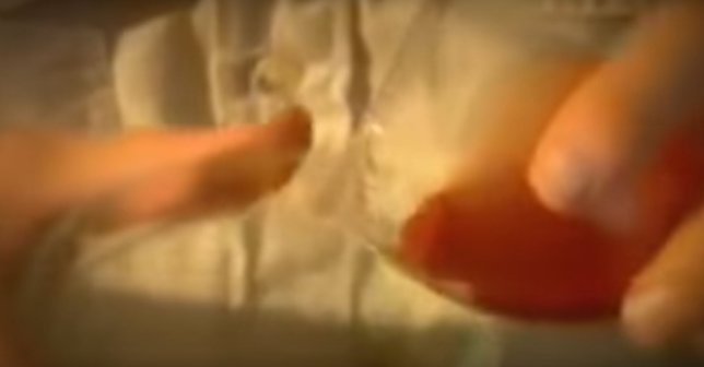 Yılan zehri kanı bakın ne hale getirdi! Görenler dehşete düştü