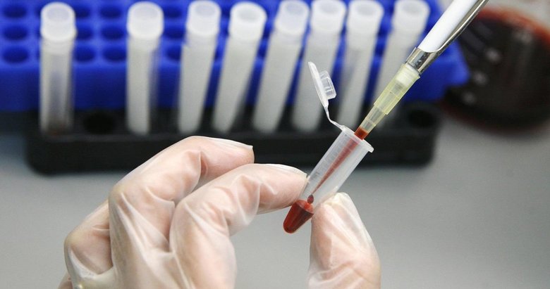 HIV olduğunu eşinden sakladı, 20 yıla kadar hapisle yargılanacak
