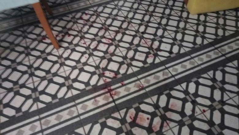 CHP’li Didim Belediye Başkanı Atabay ve avukatına beyzbol sopalı saldırı