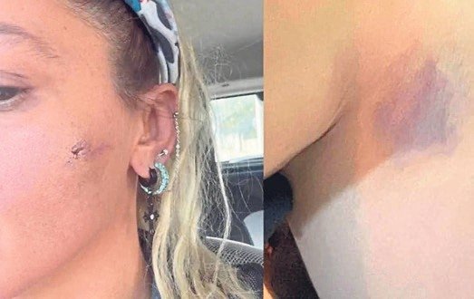 ‘Kocam tarafından darp edildim’