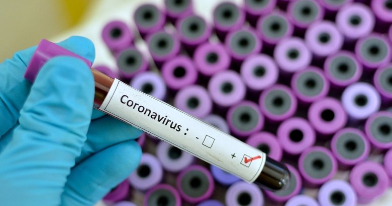 ABD’de koronavirüs kaynaklı ilk ölüm