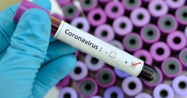 Koronavirüsle mücadelede yeni dönem: Tersine karantina