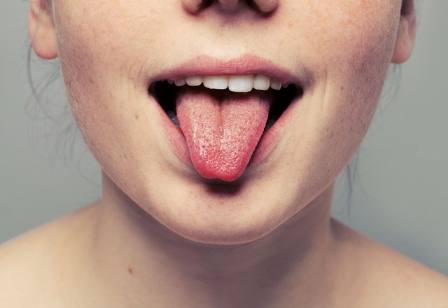 Dilinizin rengi sağlık sorununuzun bir göstergesi olabilir