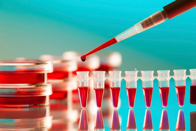 AIDS belirtileri neler? AIDS nasıl bulaşır? AIDS tedavisi var mı?