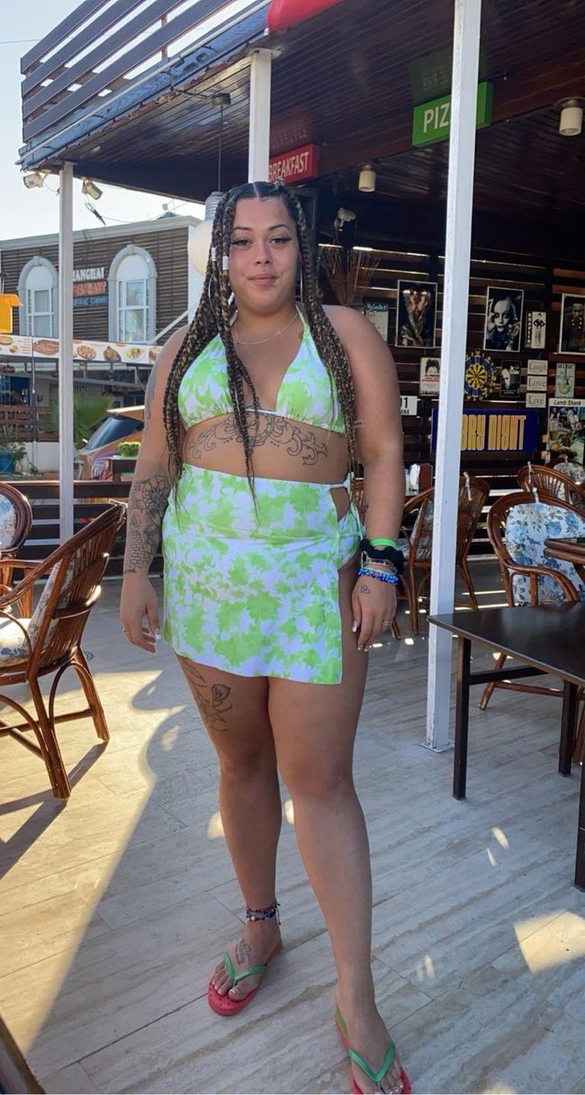 Yağ aldırmak için İzmir’e gelen İngiliz kadının hayatı karardı